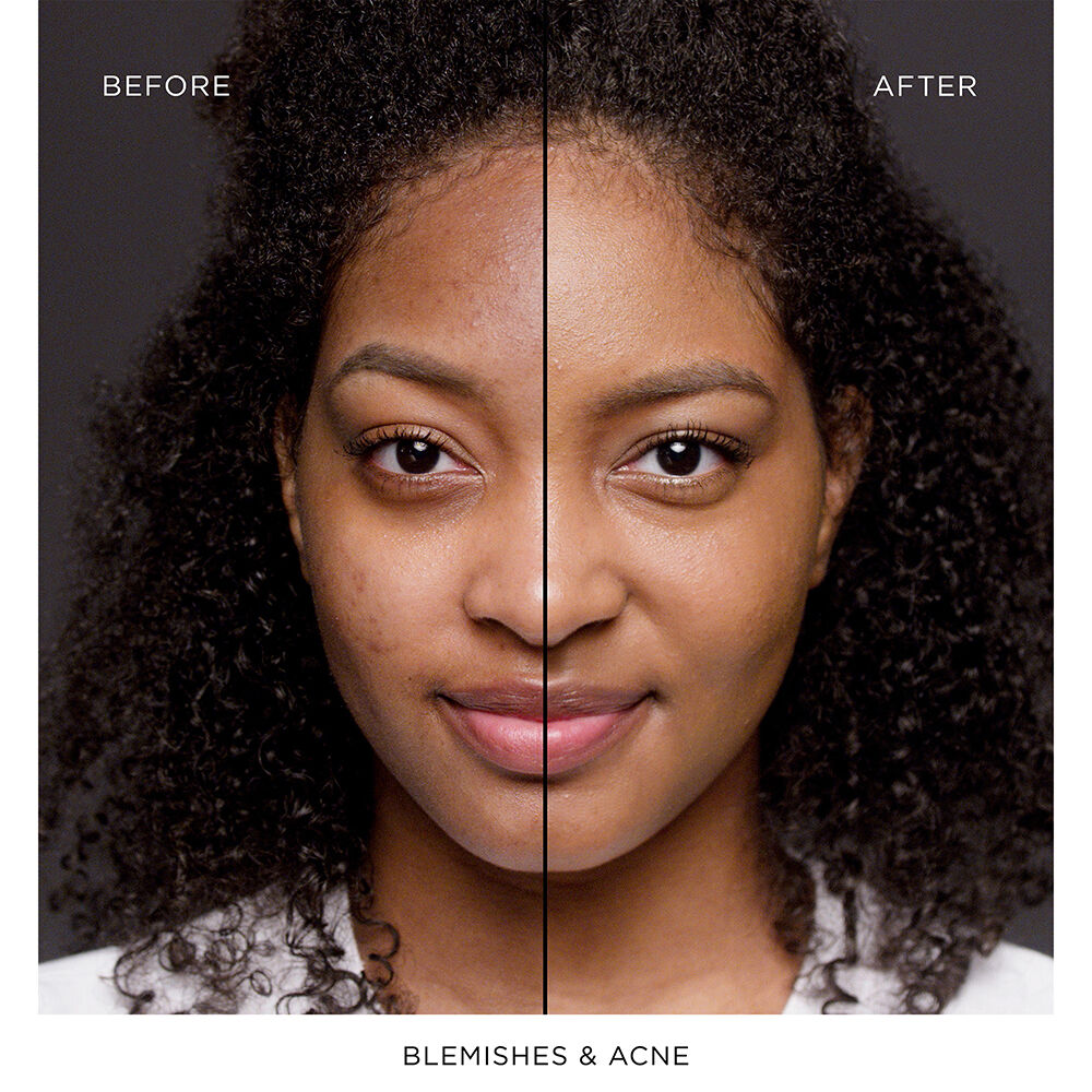 TEINT IDOLE ULTRA WEAR ALL OVER CONCEALER