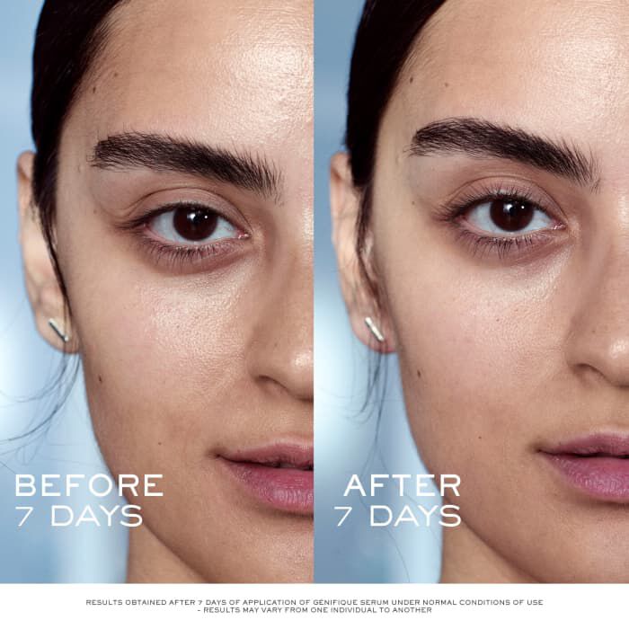 Advanced Genifique Youth Activating Serum