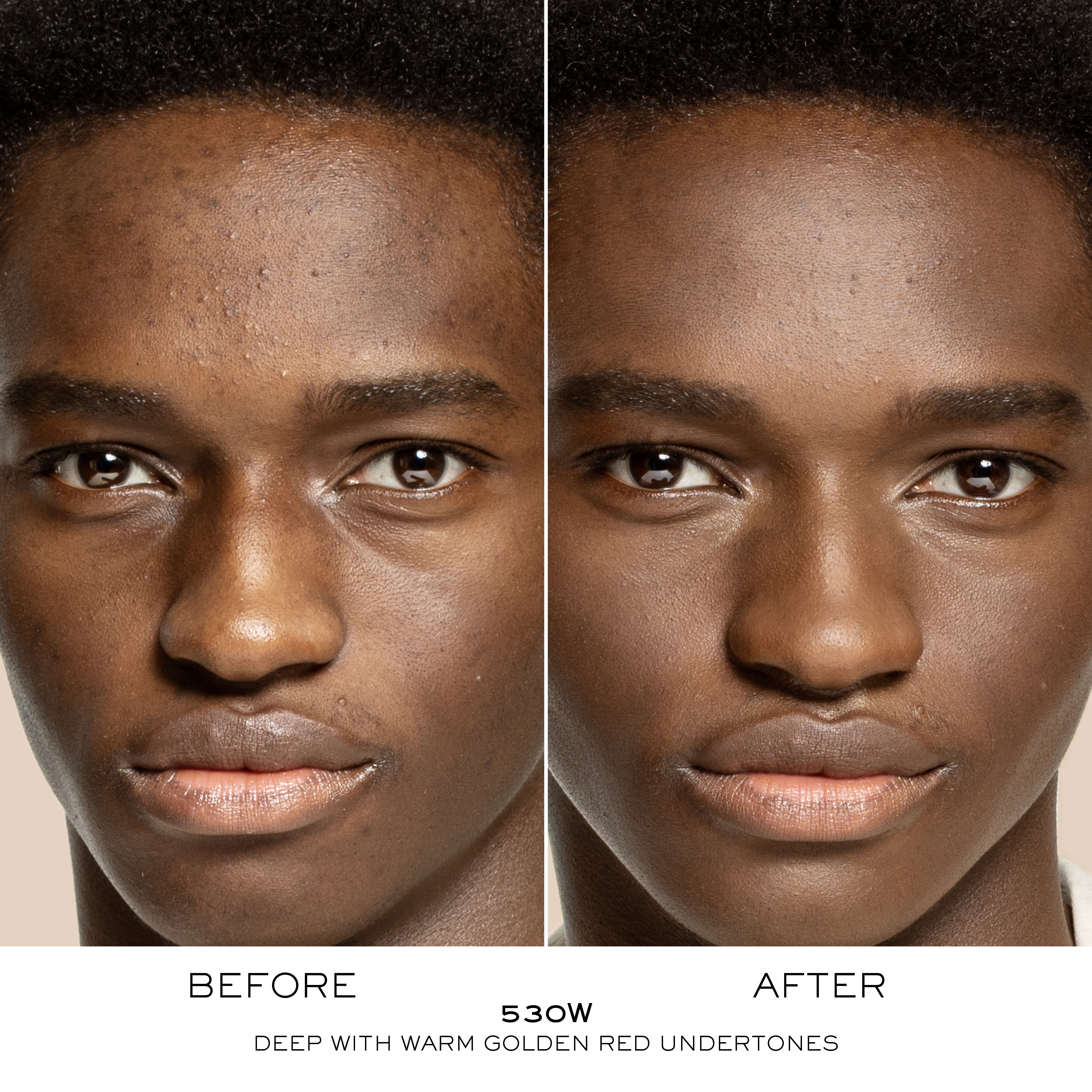 TEINT IDOLE ULTRA WEAR CARE & GLOW CONCEALER