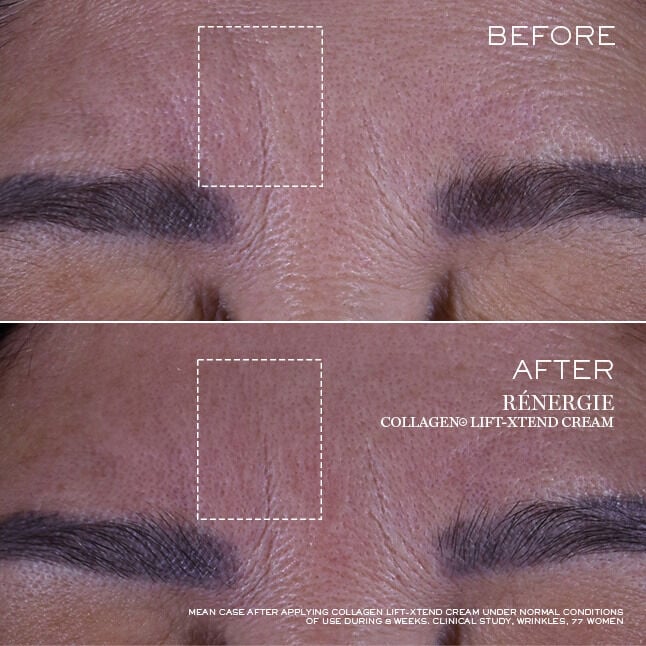 Renergie Collagen+ Lift-Xtend Cream