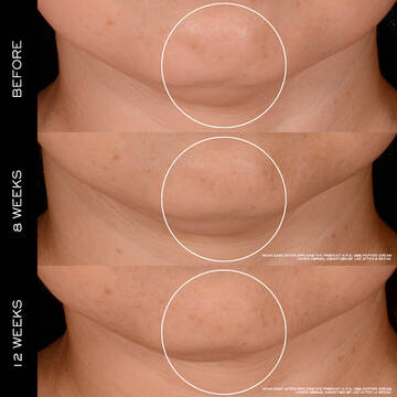 Renergie H.P.N. 300-Peptide Cream