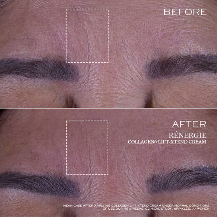 Renergie Collagen+ Lift-Xtend Cream