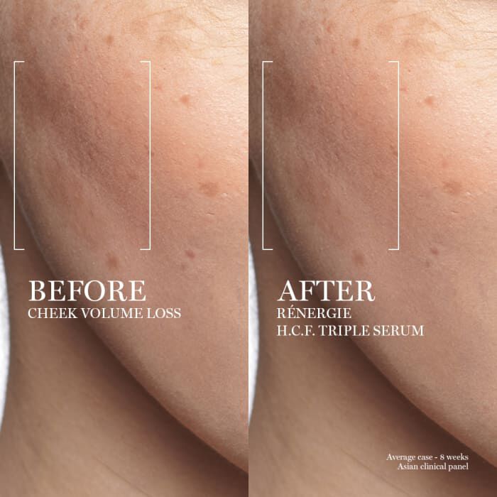 Renergie H.C.F. Triple Anti-Aging Serum