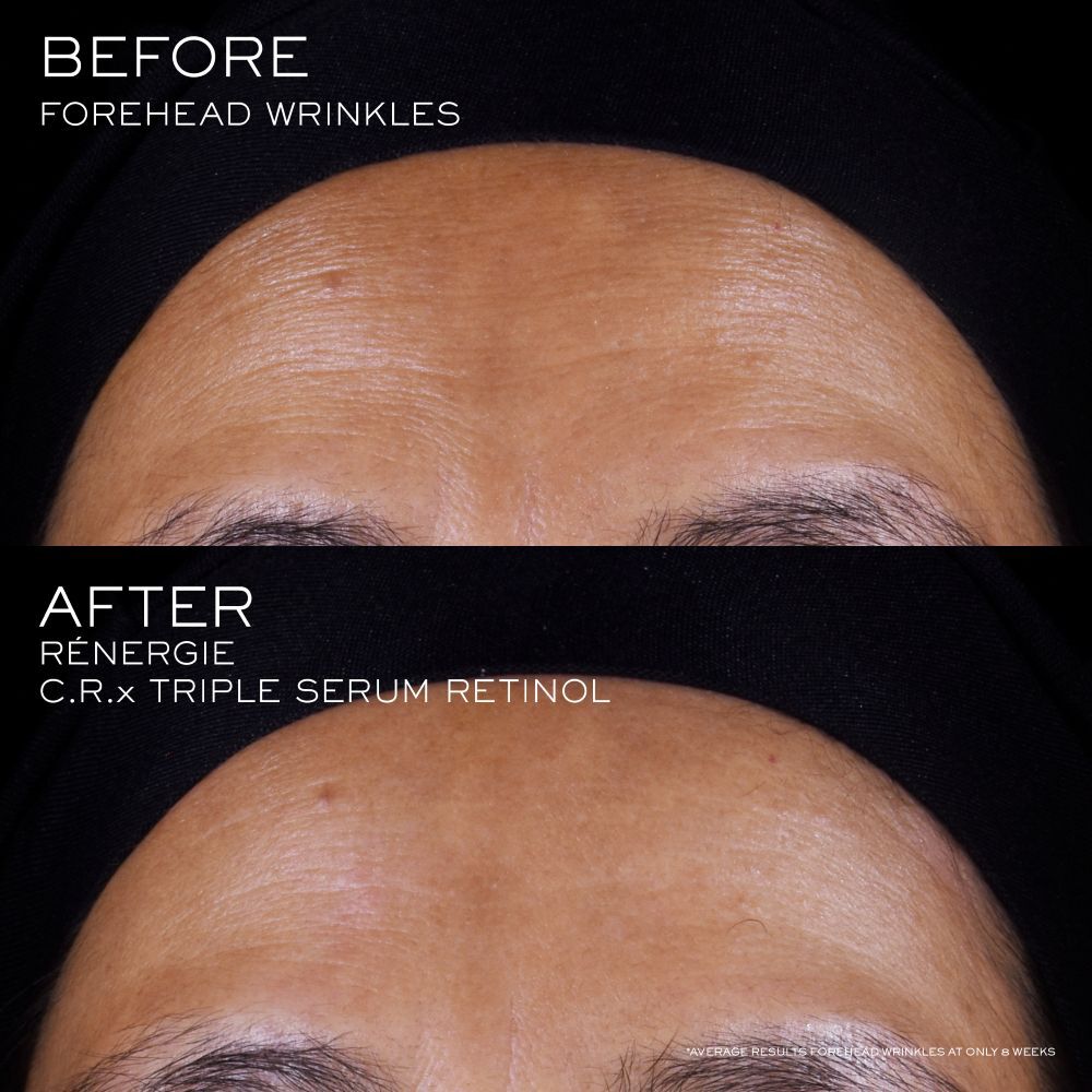 Renergie C.R.X. Triple Serum Retinol