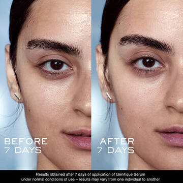 Advanced Genifique Youth Activating Serum