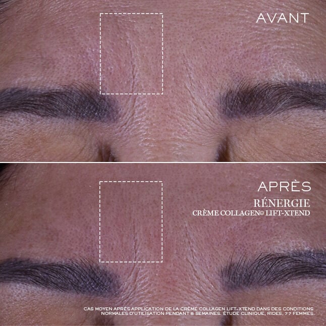 Creme Renergie Collagen+ Lift-Xtend