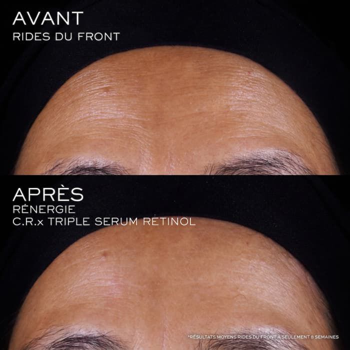 Renergie C.R.X. Triple Serum Retinol