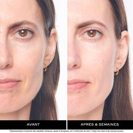 Renergie H.C.F. Triple Serum