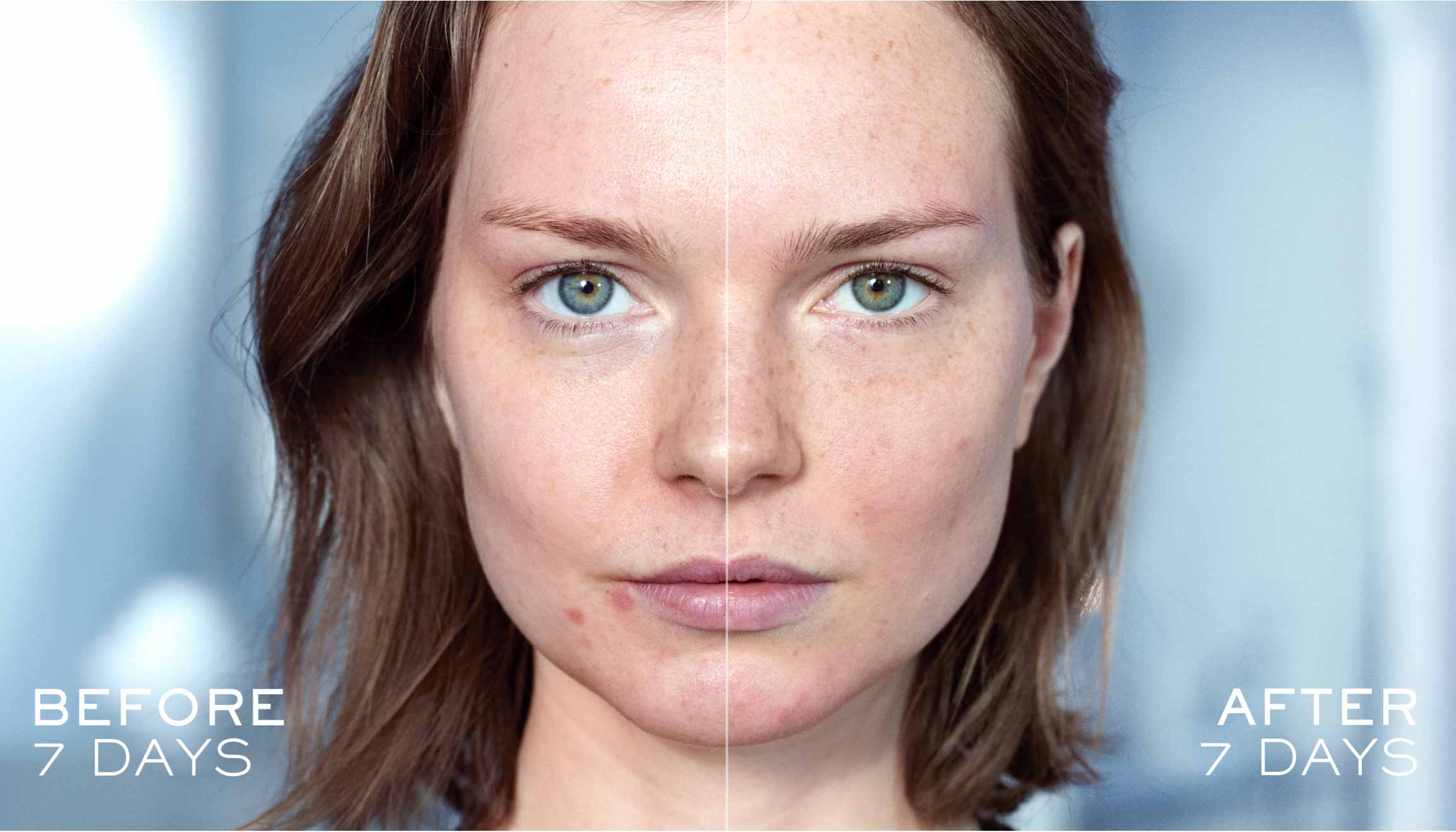 BEFORE / AFTER