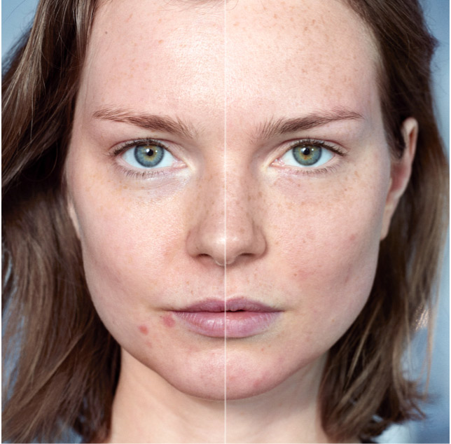 BEFORE / AFTER
