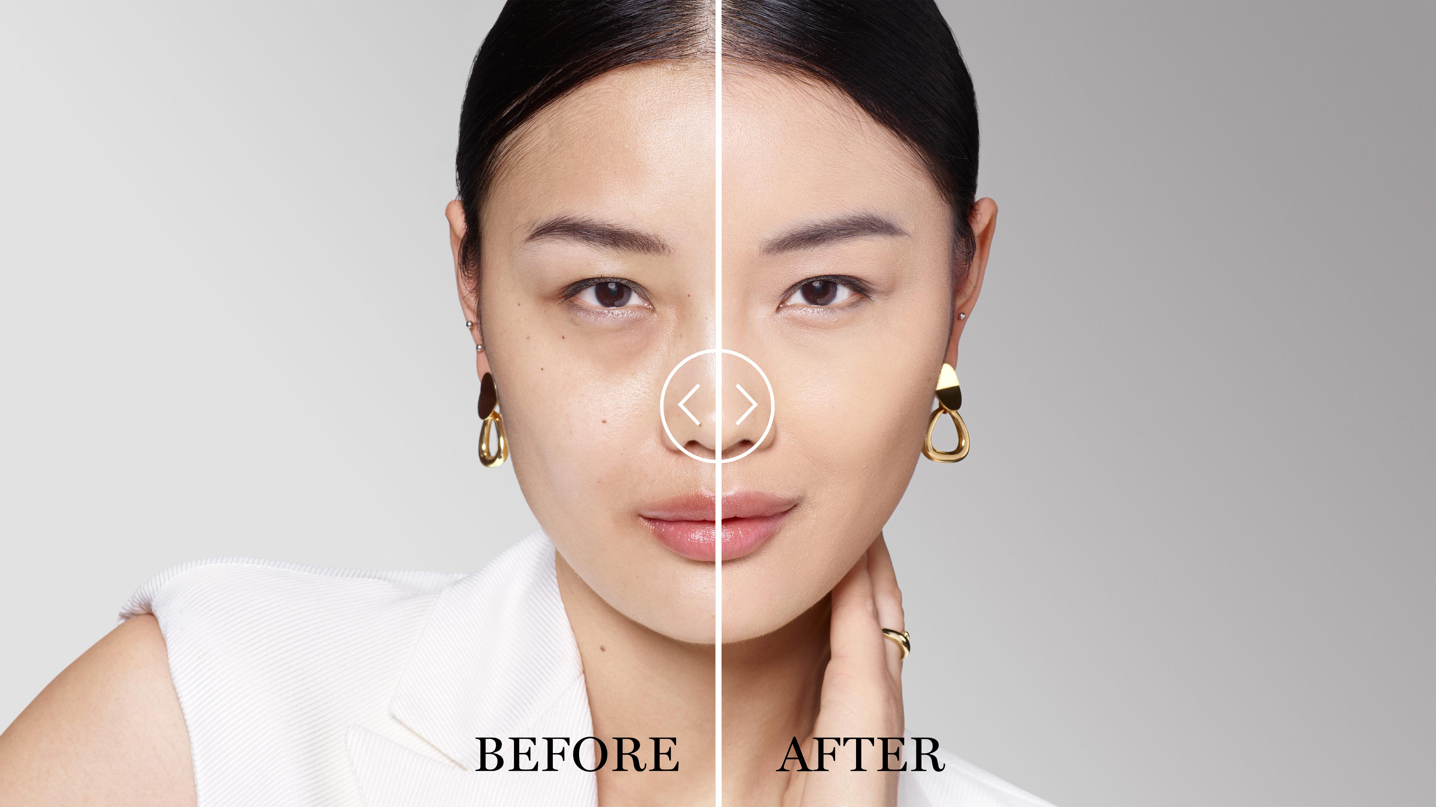 BEFORE/AFTER
