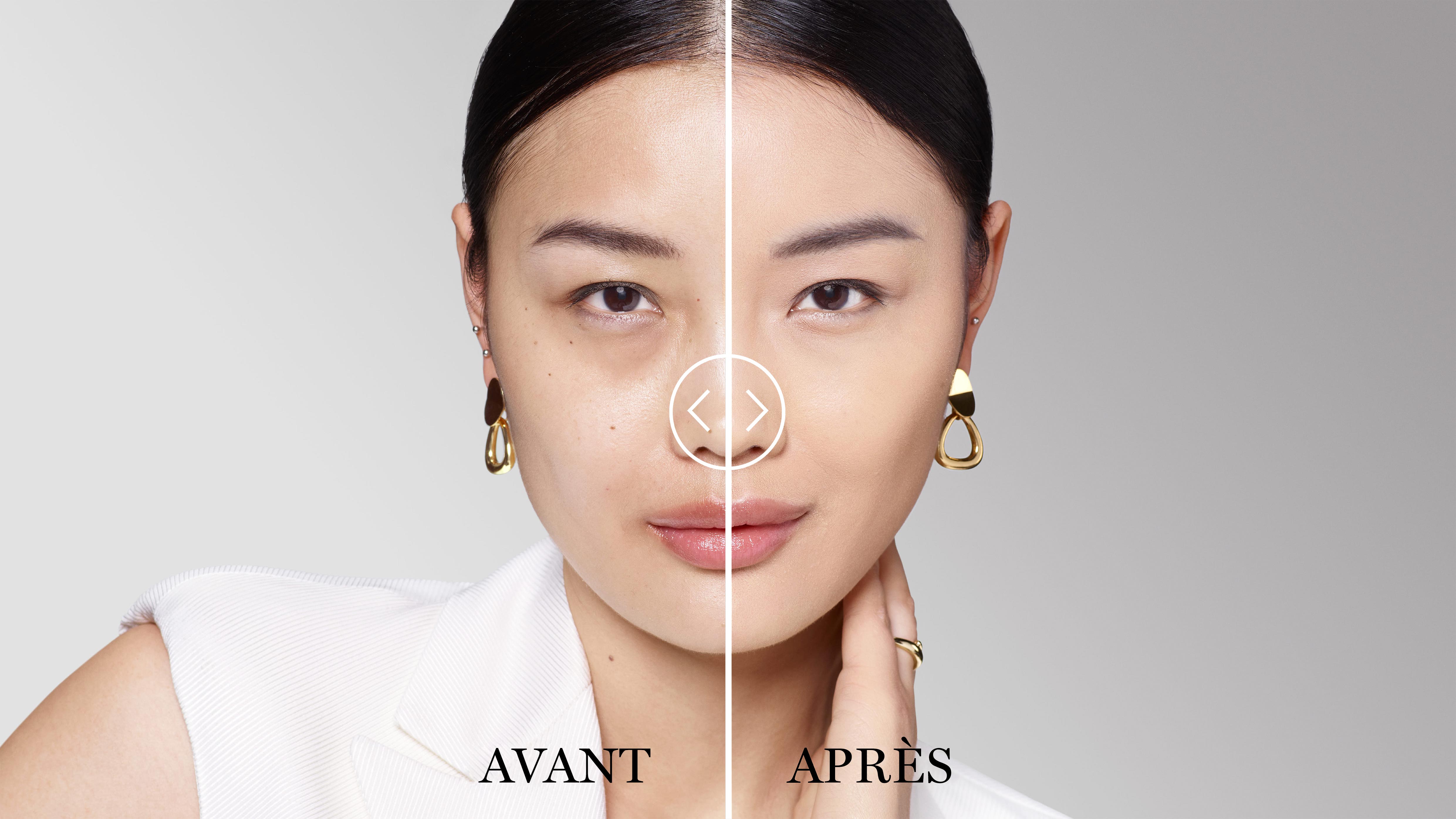 BEFORE/AFTER